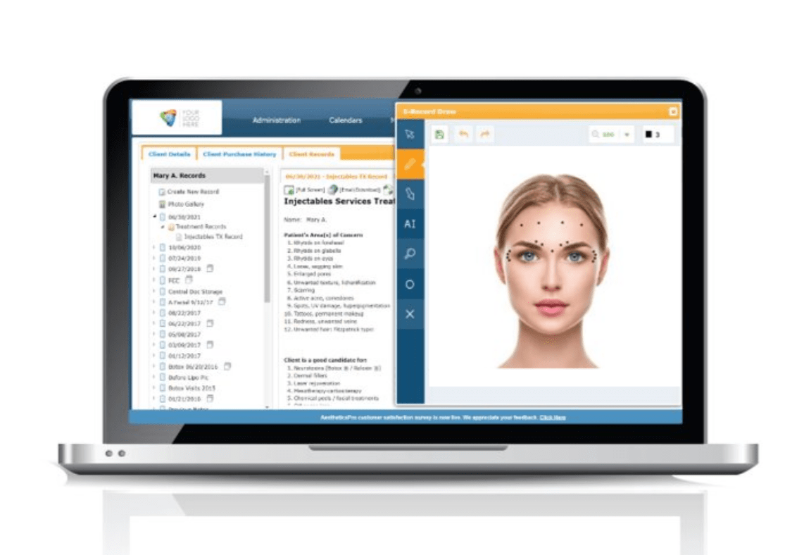 AestheticsPro EMR on computer screen - electronic record using real photo and mark-up
